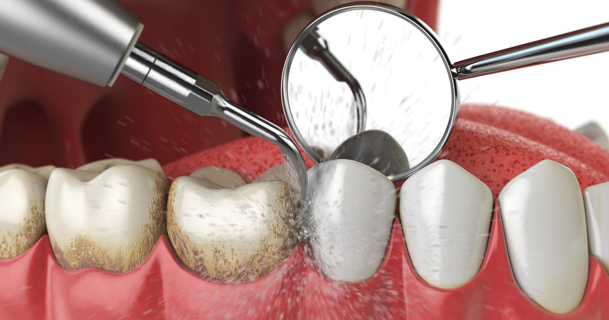 Limpeza e Prevenção